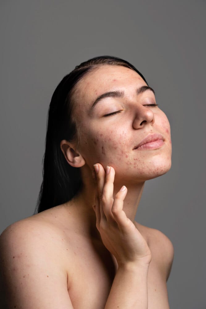 Pigmentation Ayurveda Treatment3
