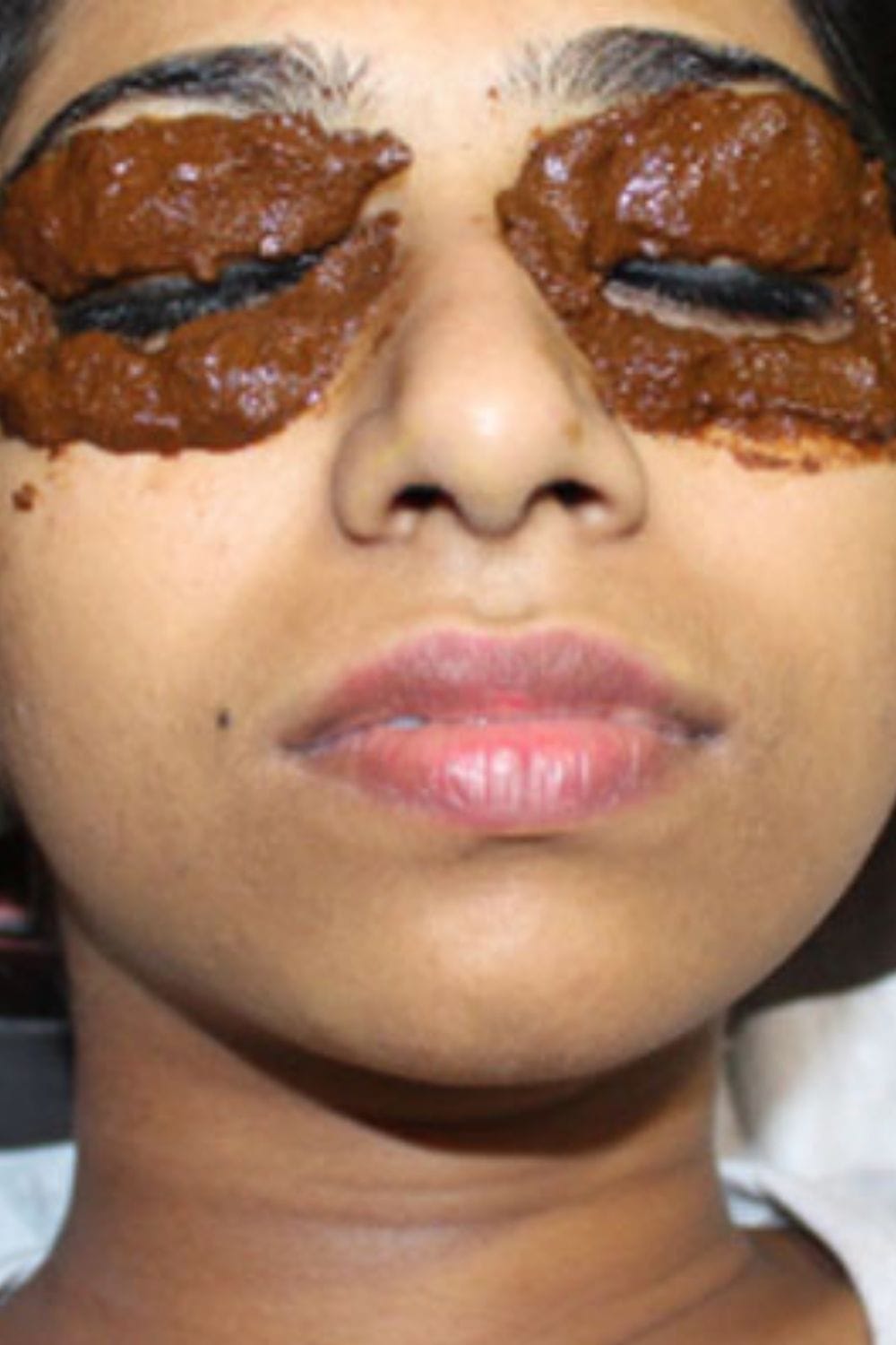Bidalakam Therapy
