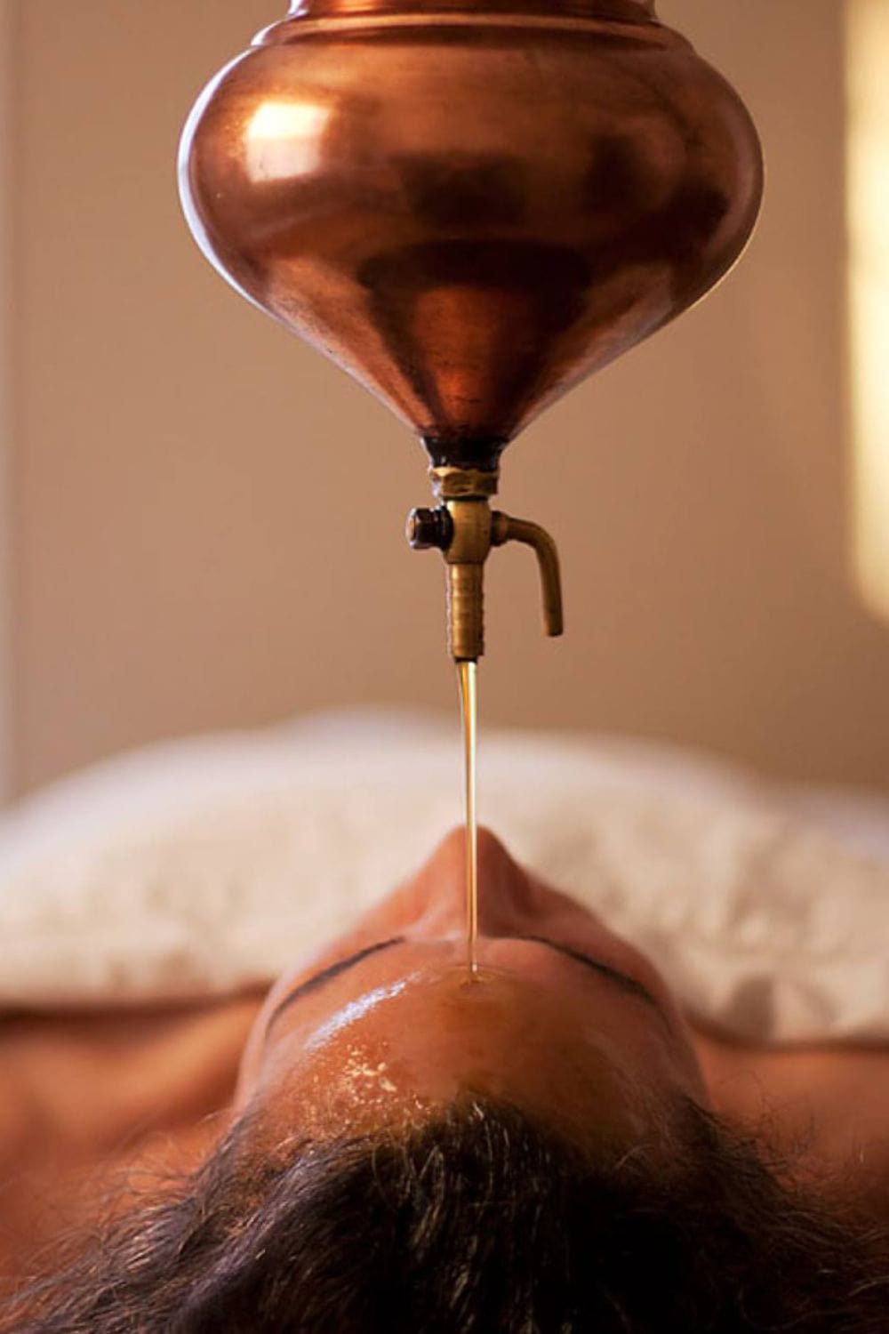 Migraine Ayurvedic Treatments Migraine Ayurvedic Treatments